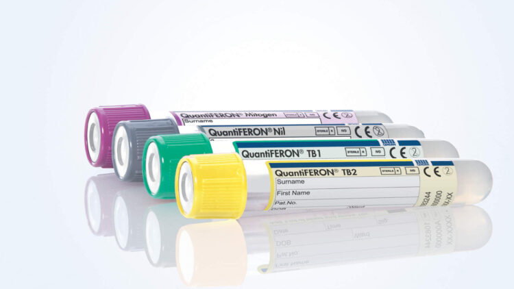 QFT-Plus, QuantiFERON-TB Gold Plus, 622222, 622526, (Spin/Tube/Plate, Photography, MDx)