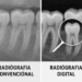 Dentistas digitales en México: planificación 3D para implantes más precisos y mejor diagnóstico