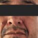 Vinculan a proceso a dentista acusado de abuso sexual contra paciente en Venustiano Carranza
